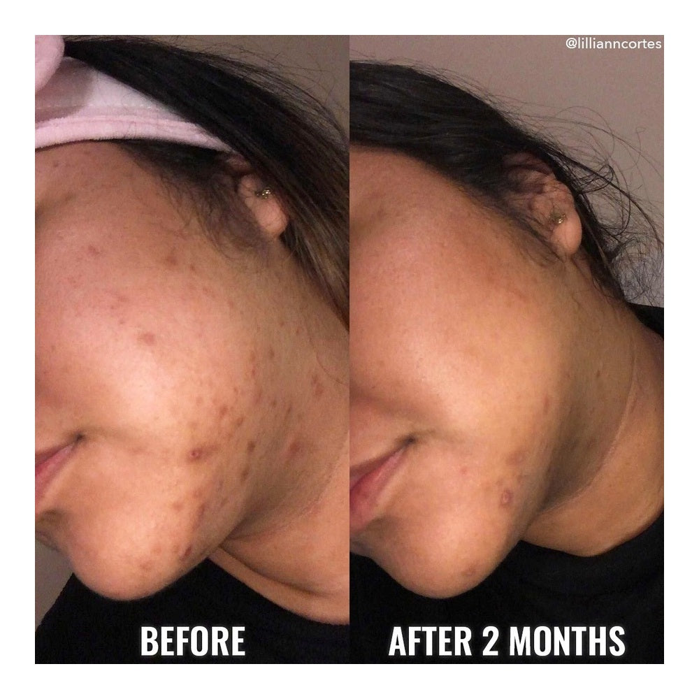 img Serum Good Molecules Despigmentante de rostro